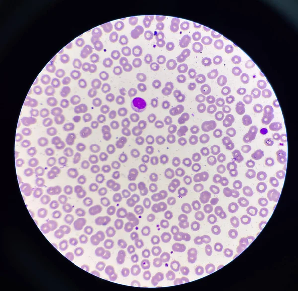 Λεμφοκύτταρα Wbc Φόντο Ερυθρών Αιμοσφαιρίων — Φωτογραφία Αρχείου