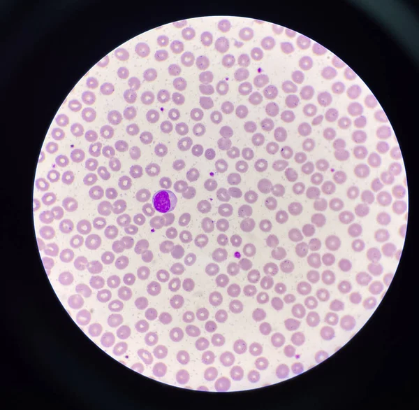 赤血球の背景にリンパ球Wbc 医学的な背景 — ストック写真
