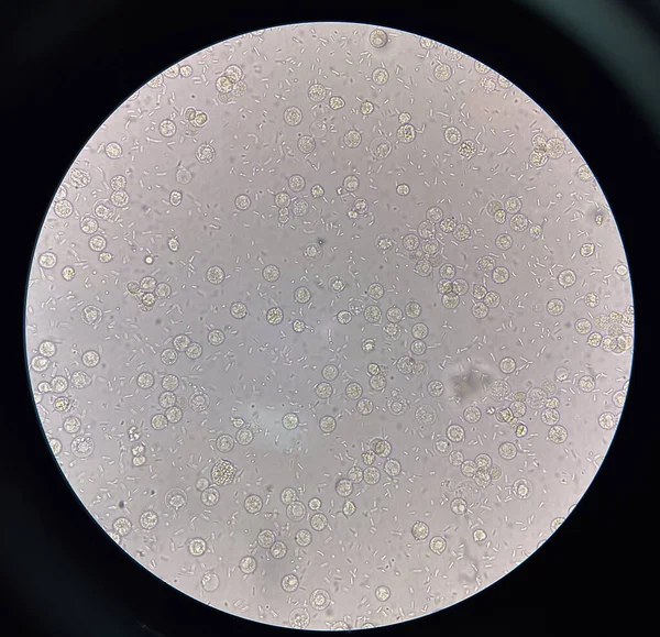 Fresh Bacteria Cell Urine Sample — Stock Photo, Image