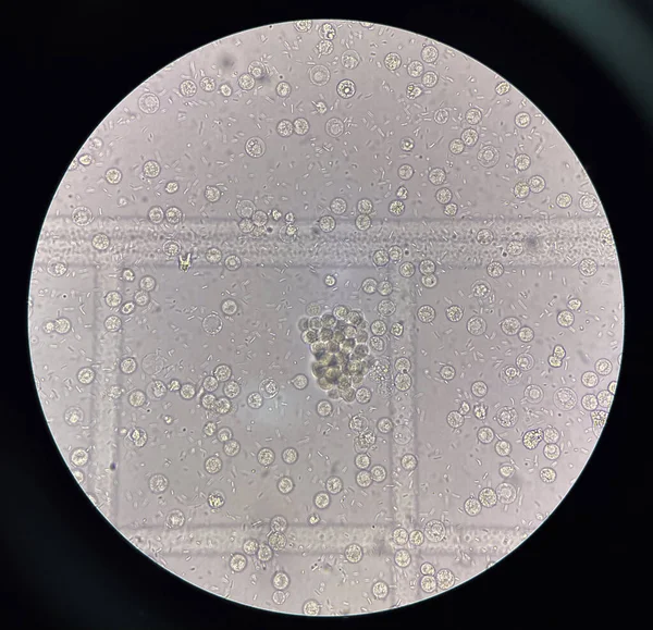 İdrar örneğinde taze bakteri hücresi.