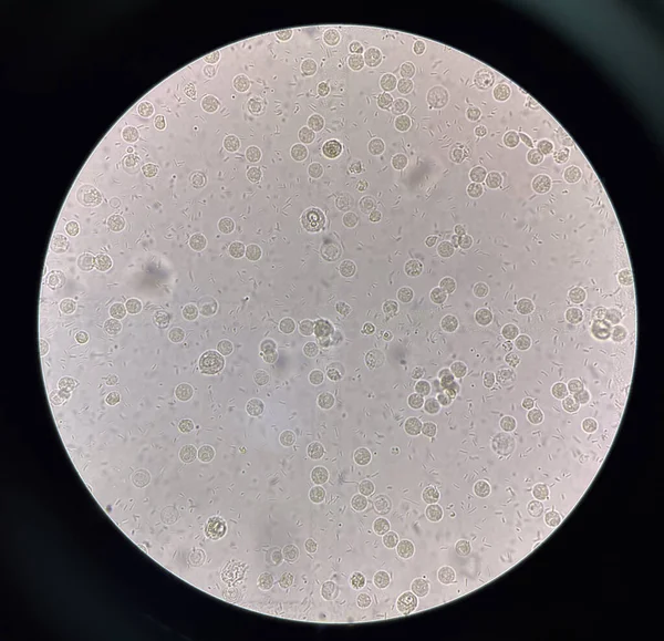 Fresh Bacteria Cell Urine Sample — Stock Photo, Image