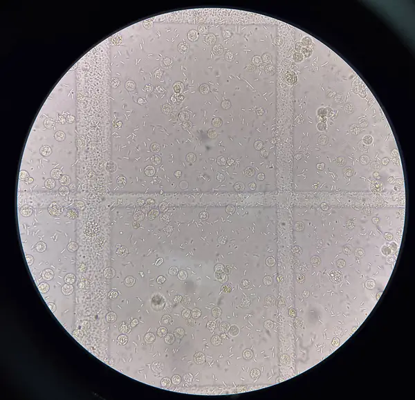 Świeże Komórki Bakterii Próbce Moczu — Zdjęcie stockowe