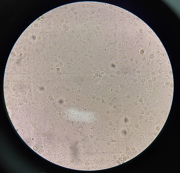 Célula Bacteriana Fresca Amostra Urina — Fotografia de Stock
