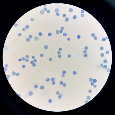 Retiküloitler kemik iliğinde yapılır ve kan dolaşımına gönderilir..