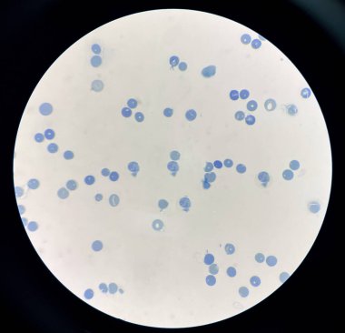 Retiküloitler kemik iliğinde yapılır ve kan dolaşımına gönderilir..