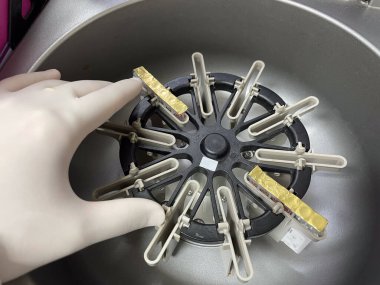 Kan bankası laboratuvarı ekipmanla kaynıyor..