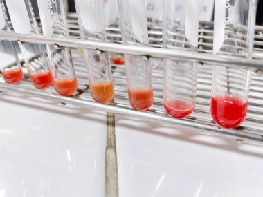 Kan bankası laboratuvarı ekipmanla kaynıyor..