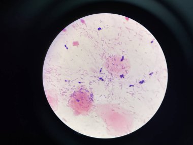 Gram lekeli maya hücresi.