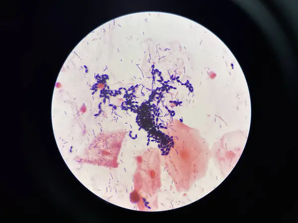 Yeast cell in gram stain.