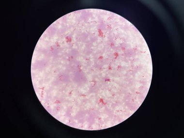 Hemokültürde orta dereceli bakteri hücresi gramı negatif basil.