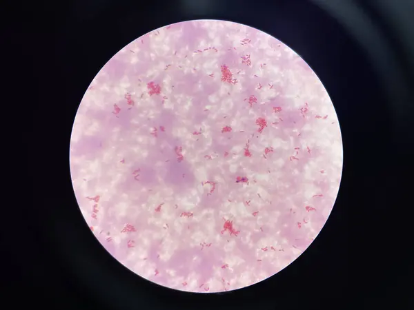 stock image Moderate bacteria cell gram negtive bacilli in hemoculture.