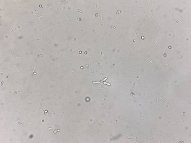 Hemokültüre sahip maya hücresi gram boyası.