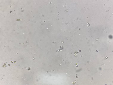 Hemokültüre sahip maya hücresi gram boyası.