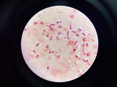 Lekeli beyaz kan hücresi