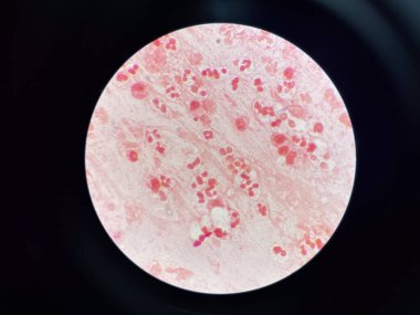 Lekeli beyaz kan hücresi