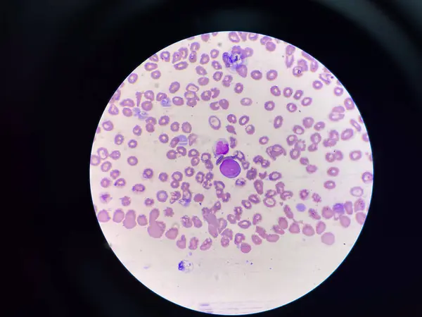 stock image White blood cell in smear