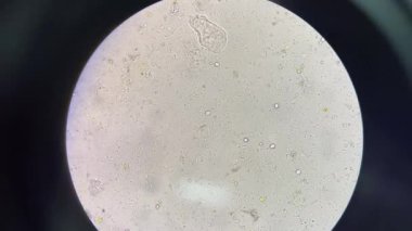 Trichomonas hominis dışkı sınavında hareket ediyor.