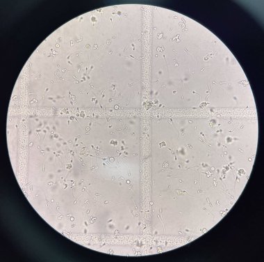 Işık mikroskobuyla sperm bulma.