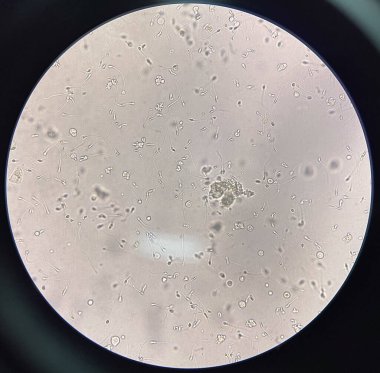 Işık mikroskobuyla sperm bulma.