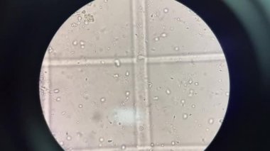 Sperm taze idrarda ilerliyor..