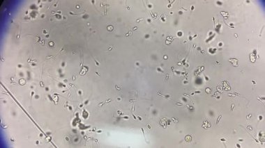 Sperm taze idrarda ilerliyor..