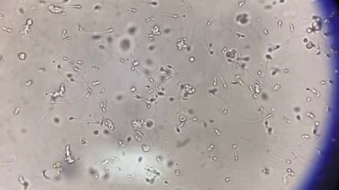 Sperm taze idrarda ilerliyor..