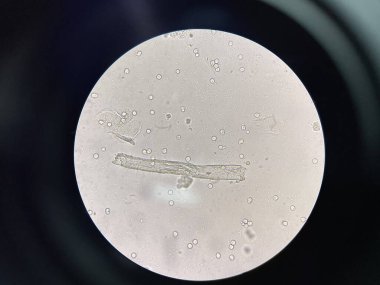 UTI idrar tortusu dosyalandı.