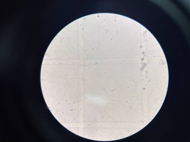 gram negatif bakteri hemokültürü.