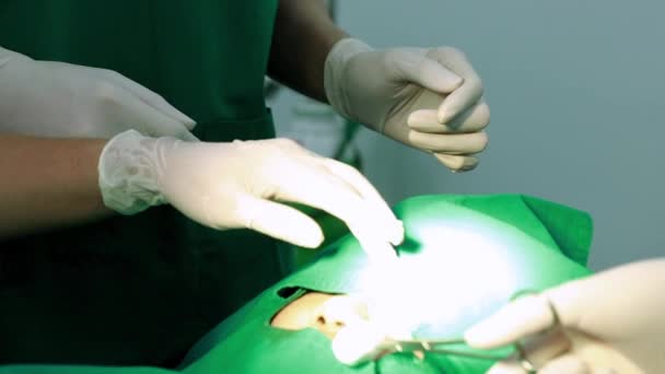 外科医生和整容小组的助手在临床上使用客户的面部外科手术器械来美化鼻子 — 图库视频影像