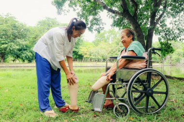 Bacakları kesilmiş ve tekerlekli sandalyede tedavi gören yaşlı bir kadını tedavi eden kız ya da hemşire sakatlığını gidermek için protez bacağını tutuyor..