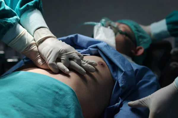 外科医生手对心脏病患者进行Cpr泵胸手术 在医院手术室抢救病人生命 外科医疗队进行手术 保健和医疗概念 — 图库照片