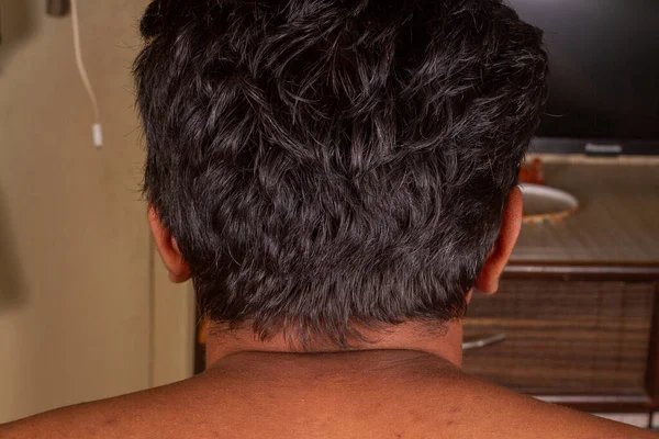 pigmentation at neck man Asia person black melanin