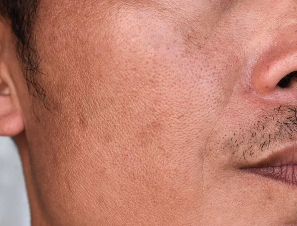 Pele Clara Com Poros Largos Face Sudeste Asiático Myanmar Homem — Fotografia de Stock