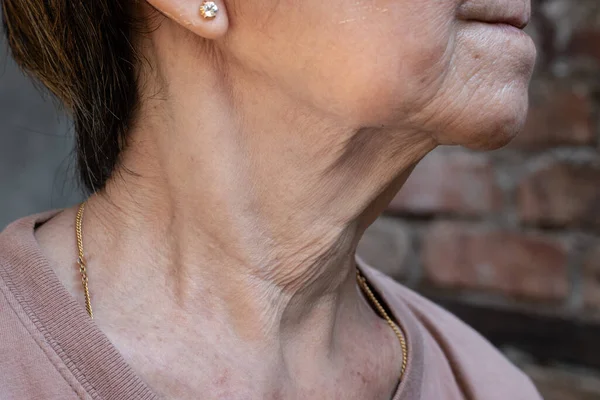 Aging Skin Folds Skin Creases Wrinkles Neck Southeast Asian Chinese — Stock Photo, Image