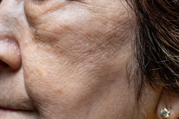 Rugas Afrouxamento Pele Face Sudeste Asiático Mulher Idosa Chinesa — Fotografia de Stock