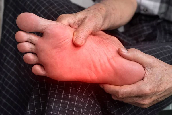 Diyabet Hastası Asyalı Yaşlı Adamın Ayağında Karıncalanma Yanma Hissi Ayak — Stok fotoğraf