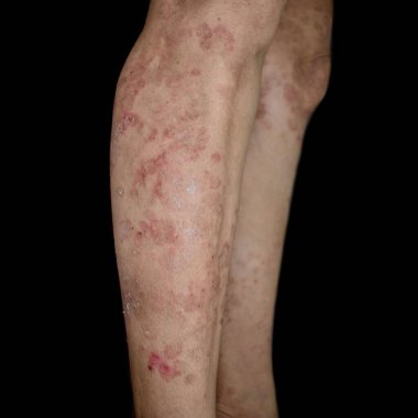 Asyalı bir kadının bacağında 