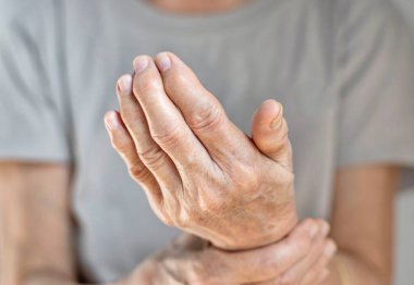 Inflammation of hand joints. Concept and idea of rheumatic arthritis, rheumatism, gout, joint swelling or arthralgia.