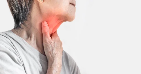 Redness at the neck of Asian, Myanmar woman. Concept of sore throat, pharyngitis, laryngitis, esophagitis, thyroiditis, or dysphagia.