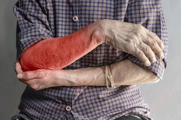 Pain in the upper arm of Southeast Asian elder woman. Concept of elbow  and forearm pain, injury or muscle problem.