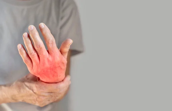 Handleder Inflammation Begreppet Reumatisk Artrit Reumatism Gikt Ledsvullnad Eller Artralgi Royaltyfria Stockbilder