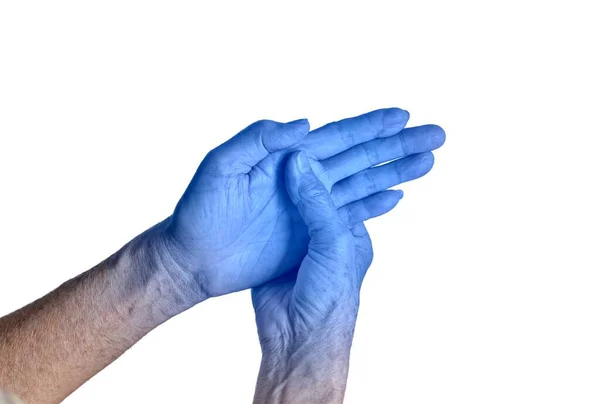 Блакитна Рука Азіатського Юнака Концепція Холодної Незграбної Руки — стокове фото