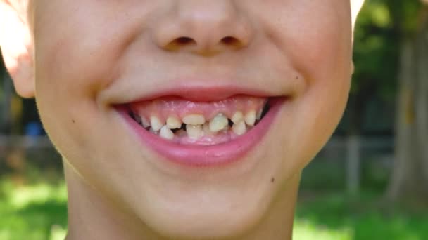 Посмішка Хлопчика Років Зміною Молочних Зубів Вирощуванням Постійних Зубів Концепція — стокове відео