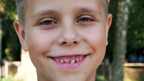 Smile Boy Years Old Changing Milk Teeth Growing Permanent Teeth — 图库视频影像
