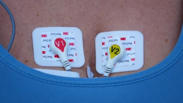 Kharkiv Ukraine January 2022 Holter Monitor Device Daily Monitoring Electrocardiogram — Vídeo de Stock