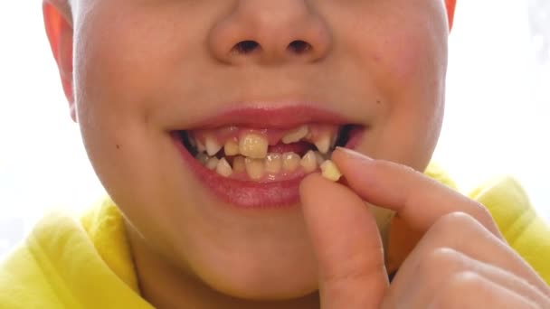 Child Holds Newly Fallen Milk Tooth Mouth Child Shows Baby — Stock Video