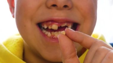 Çocuk sarkmış bir ön süt dişini ağzının önünde tutuyor. Çocuklarda diş değişimi. Pediatrik dişçilik kavramı. Çocukların dişleriyle ilgilenmek. Çocuklar için diş macunu