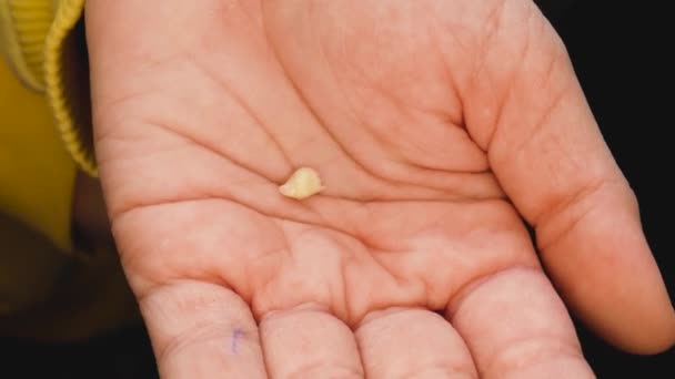 幼儿手掌心上的一颗婴儿牙 一颗乳牙掉了 儿童乳牙的替换 儿科牙科学 儿童的牙科护理 — 图库视频影像