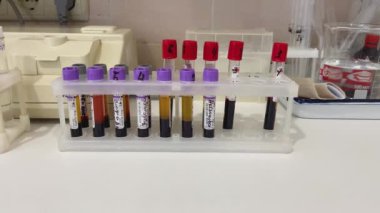 Tıbbi bir laboratuarda analiz için bir sürü etiketli kan tüpü. Hastaların teşhisini belirlemek için kan testleri..