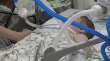 Kharkiv, Ukrayna - 28 Haziran 2022: Doktor çocuğu hastane odasında muayene ediyor. Çocuk solunum cihazına bağlı. Ölümcül hasta çocukları kurtarmak
